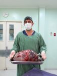 tumor-de-15kg-e-retirado-de-moradora-de-rio-das-ostras